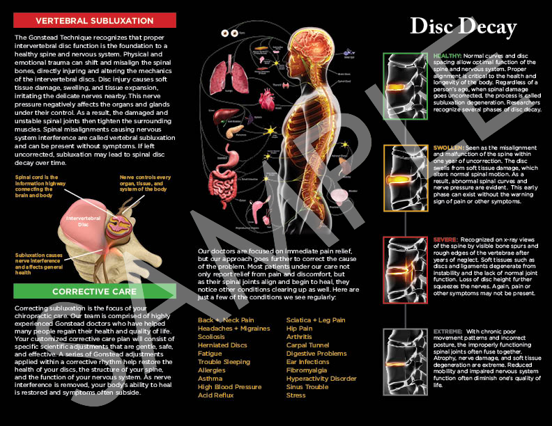 Subluxation Brochure