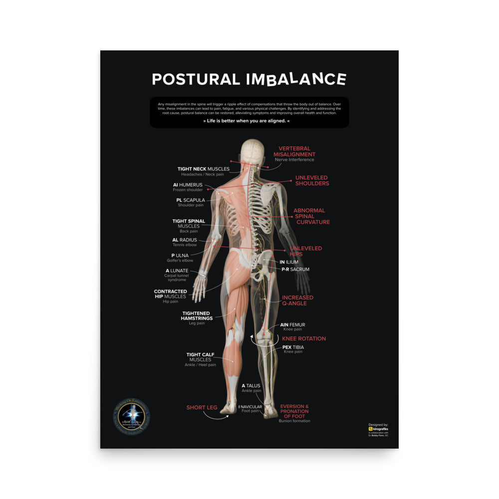 Gonstead Extremity Poster