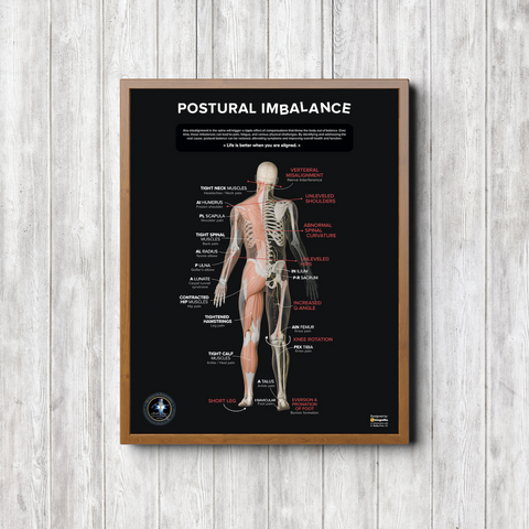 Gonstead Extremity Poster